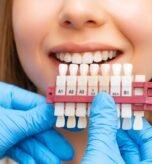 A dental professional compares a patient's teeth shade to a dental shade guide during a teeth whitening procedure, highlighting effective dental care practices.