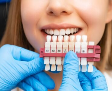 A dental professional compares a patient's teeth shade to a dental shade guide during a teeth whitening procedure, highlighting effective dental care practices.