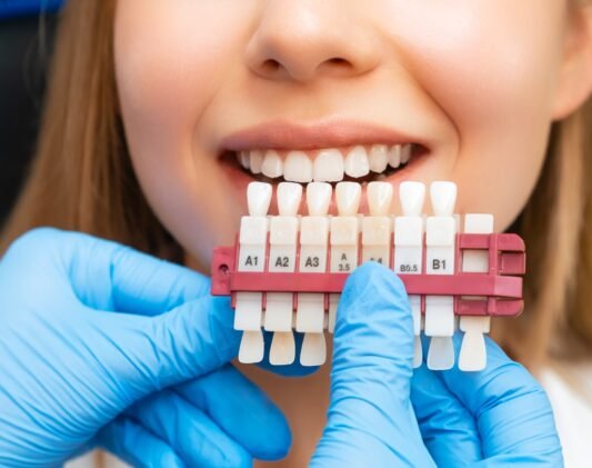 A dental professional compares a patient's teeth shade to a dental shade guide during a teeth whitening procedure, highlighting effective dental care practices.